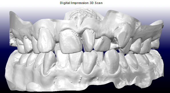 3D Scan