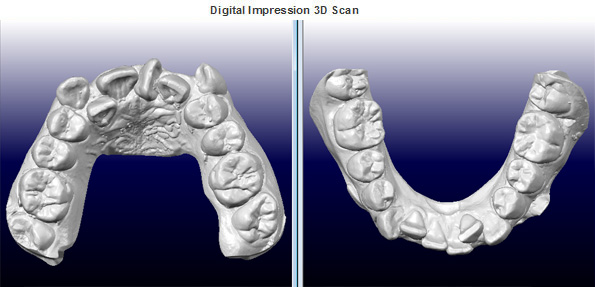 3D Scan